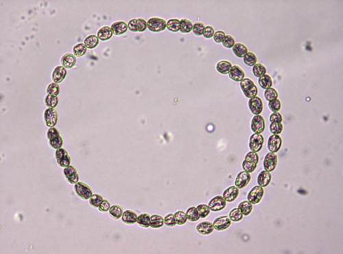 An image a phytoplankton specimen