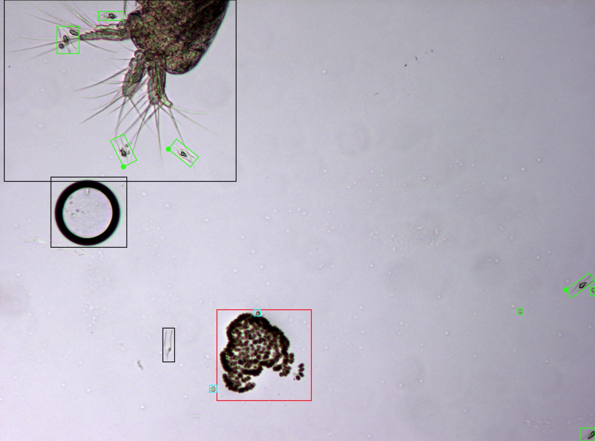 Example image of the microscopy image freshwater phytoplankton dataset